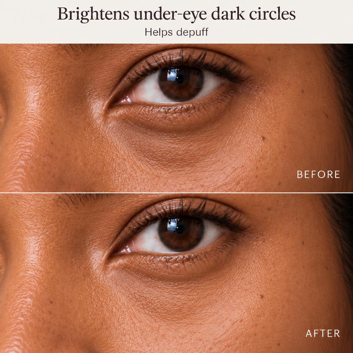 CRYO EYE PATCHES